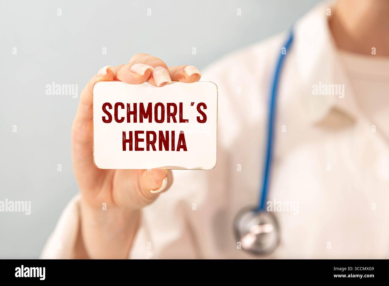 Red inflamed spine with a compressed nerve root, close-up. Neuralgia ...