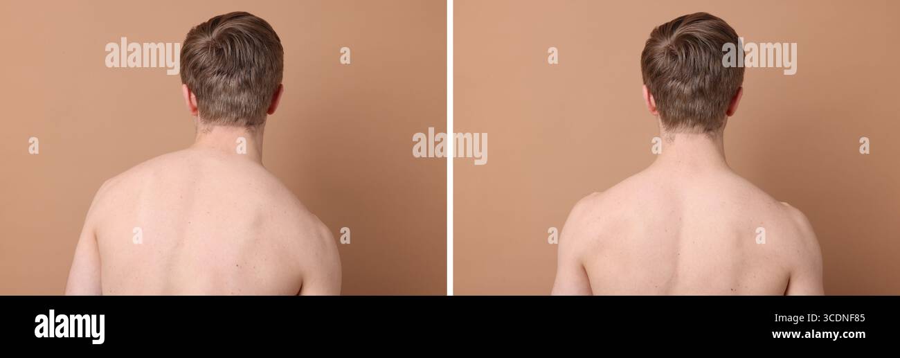 Before and after collage showing man with good and bad posture against ...