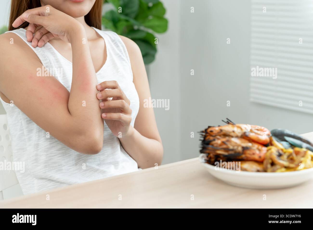food allergies, women have reactions itching and redness after eating ...