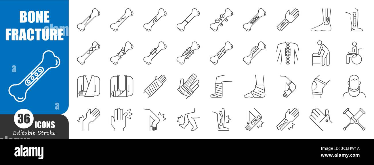 Bone fracture thin line icon . Editable stroke . Vector . Stock Vector