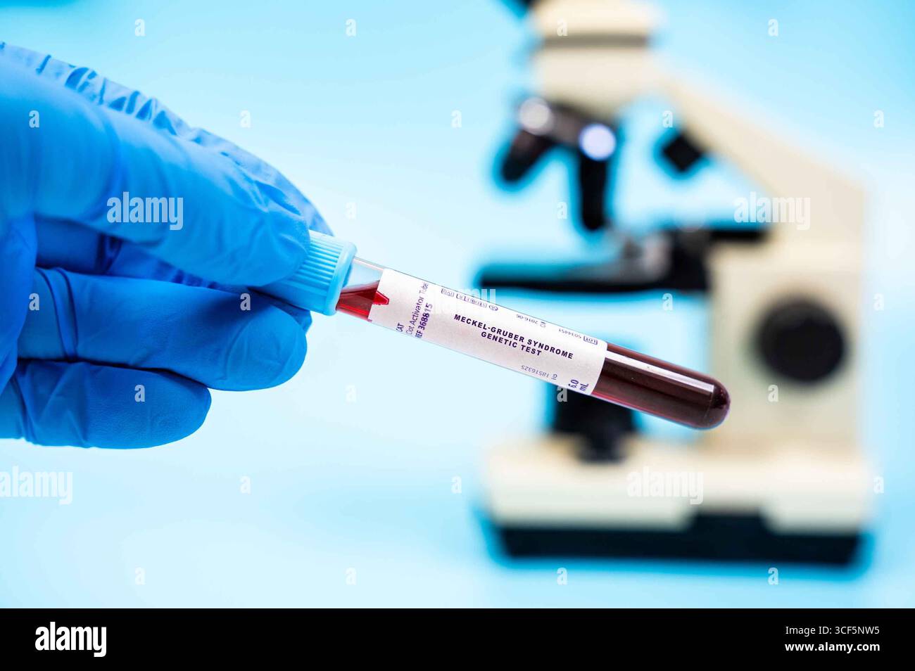 Detects mutations in genes like MKS1, leading to Meckel-Gruber syndrome, affecting multiple organs. blood test in lab Stock Photo