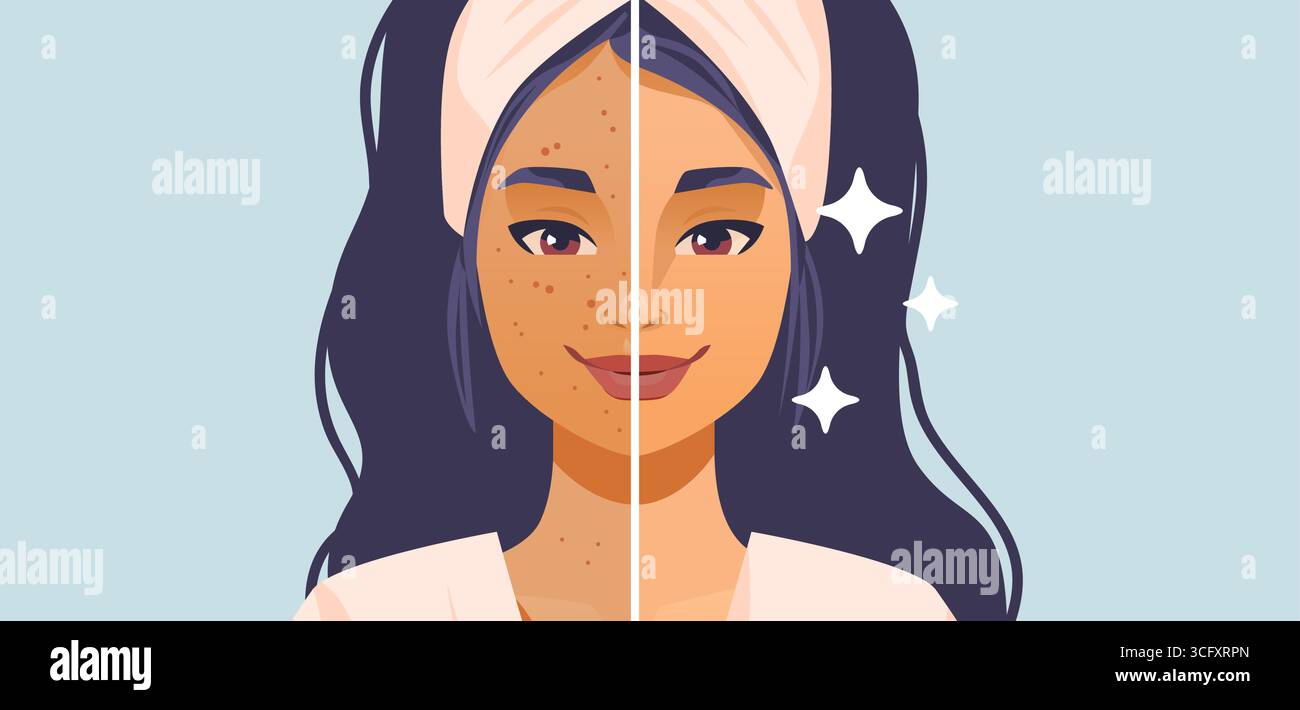 Woman skincare before and after acne treatment facial split clean ...