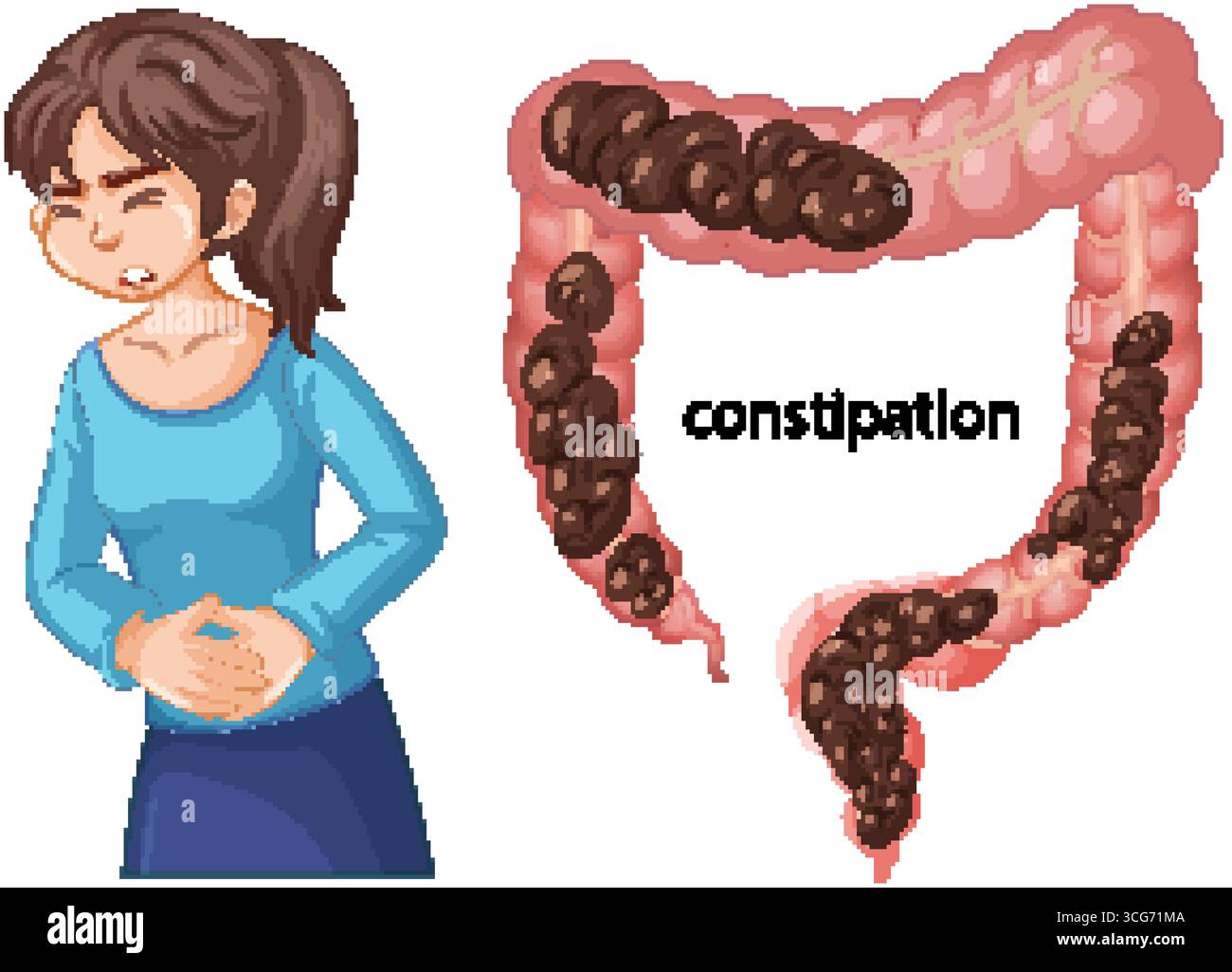 Vector illustration showing a woman experiencing constipation alongside ...