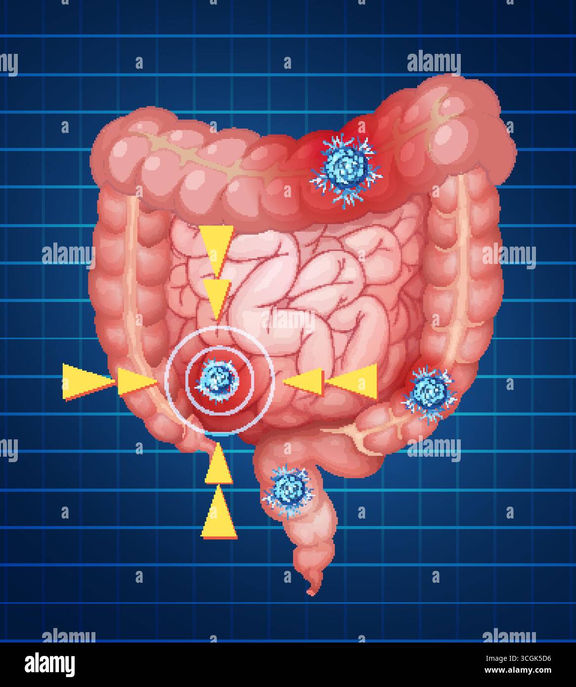 Pinpy Intestines Diagram of the human large intestines hi-res stock photography and ...
