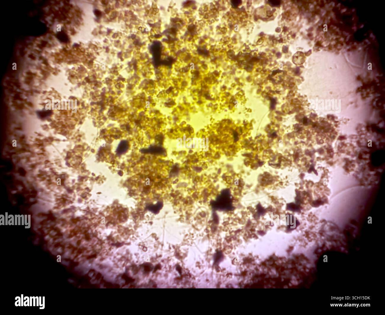 Bacteria under microscope hi-res stock photography and images - Alamy