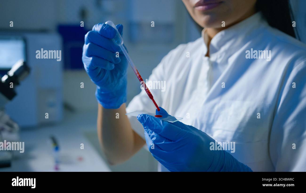 A lab technician uses a pipette to transfer blood samples onto a slide ...