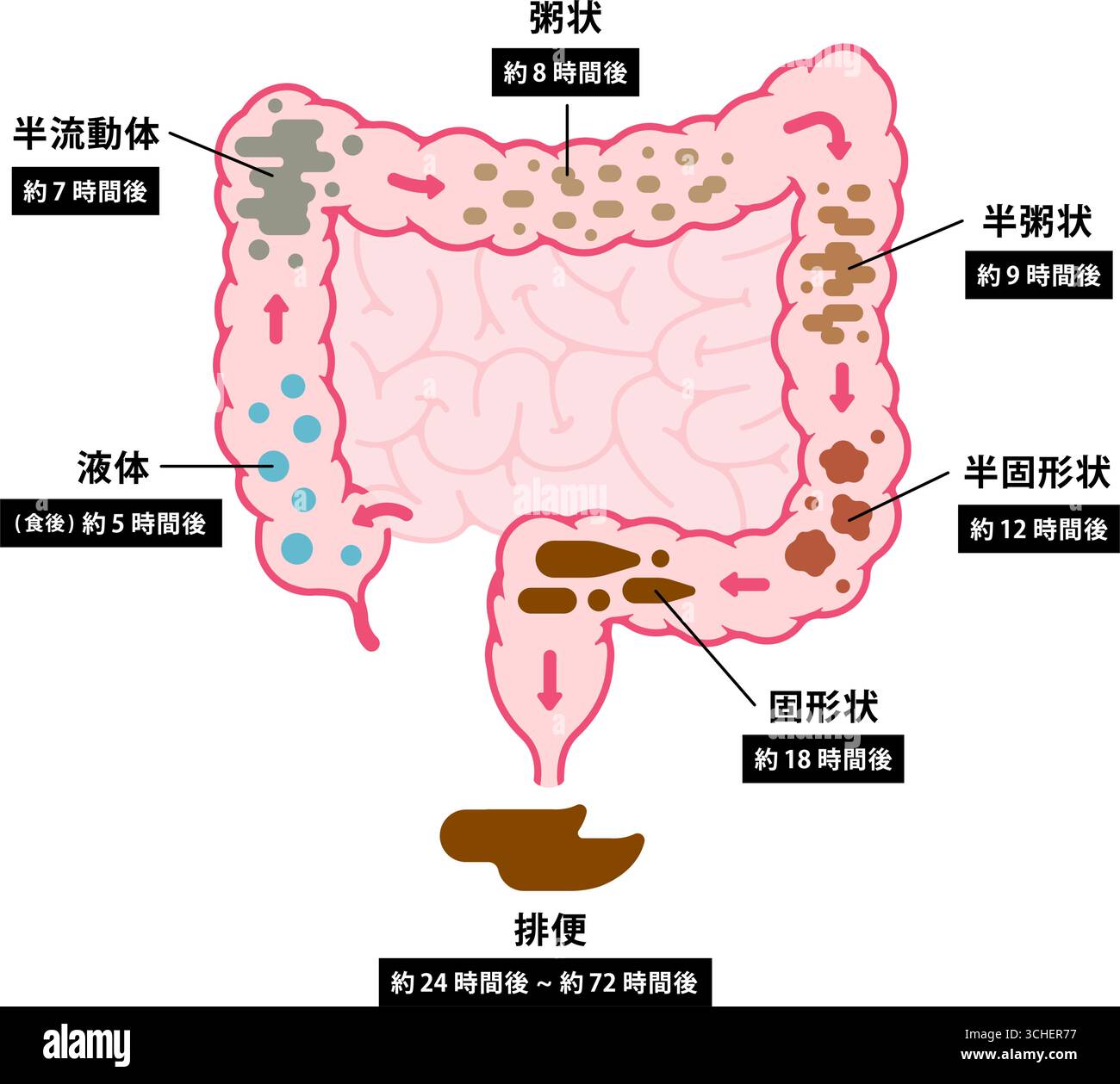 Small and large intestine inflammation Stock Vector Images - Alamy