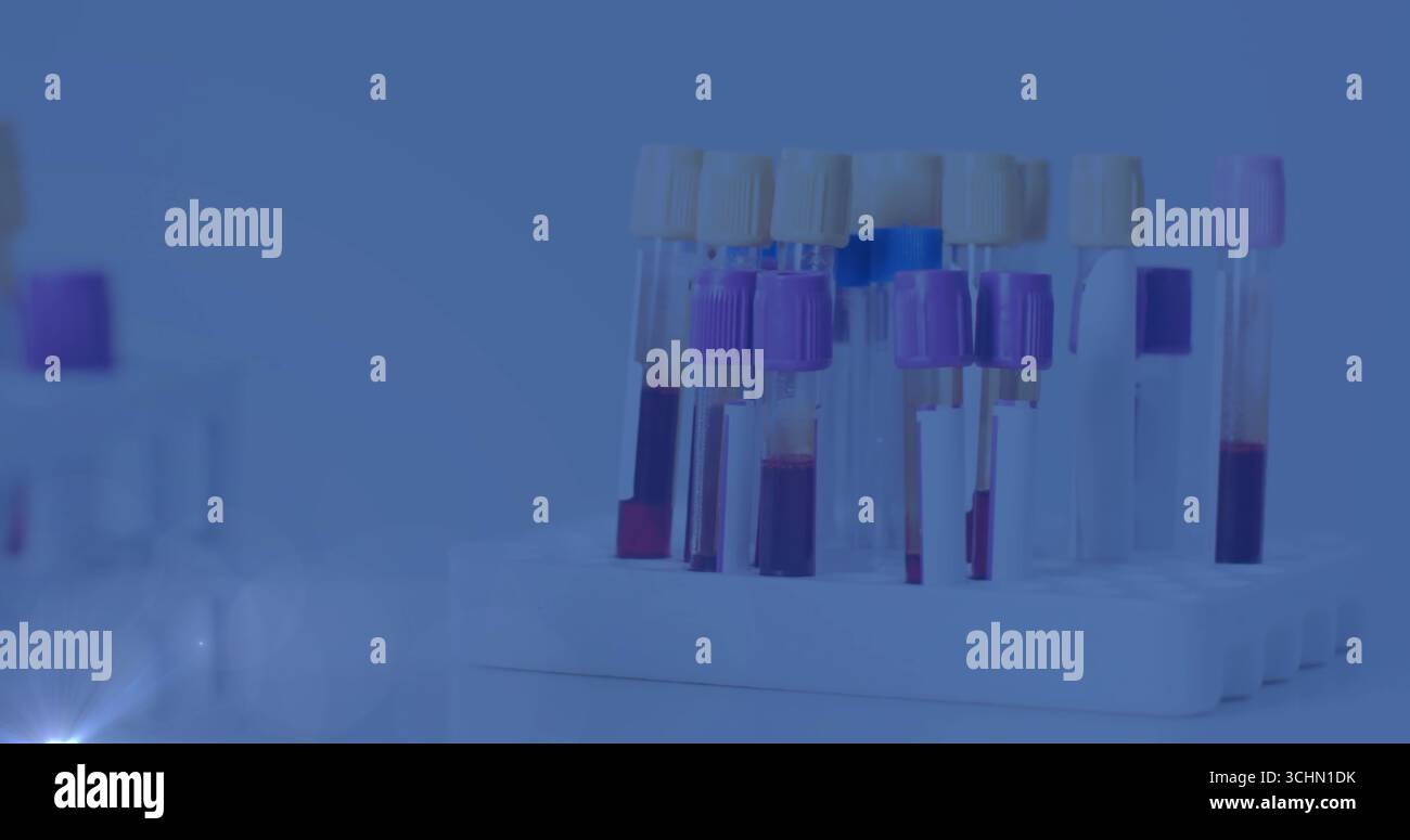 Presenting plastic test tube rack holding colored blood tubes on lab ...