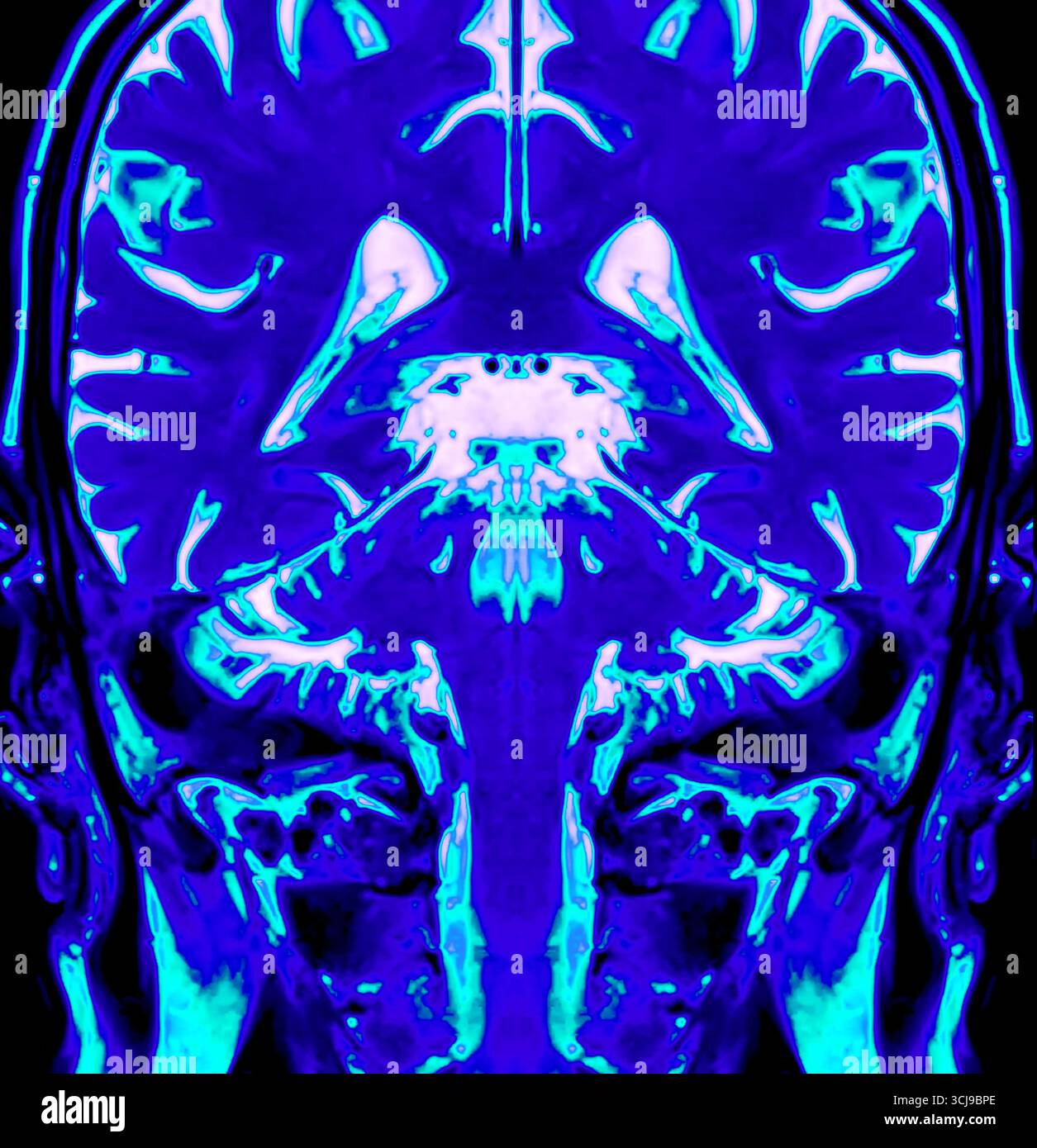 The color-enhanced MRI reveals the brain’s anatomy in striking hues. It ...