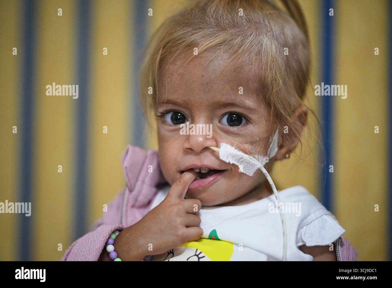 Shamm Qudeih, 2, sits on her bed at the Santobono Pausilipon Children's ...