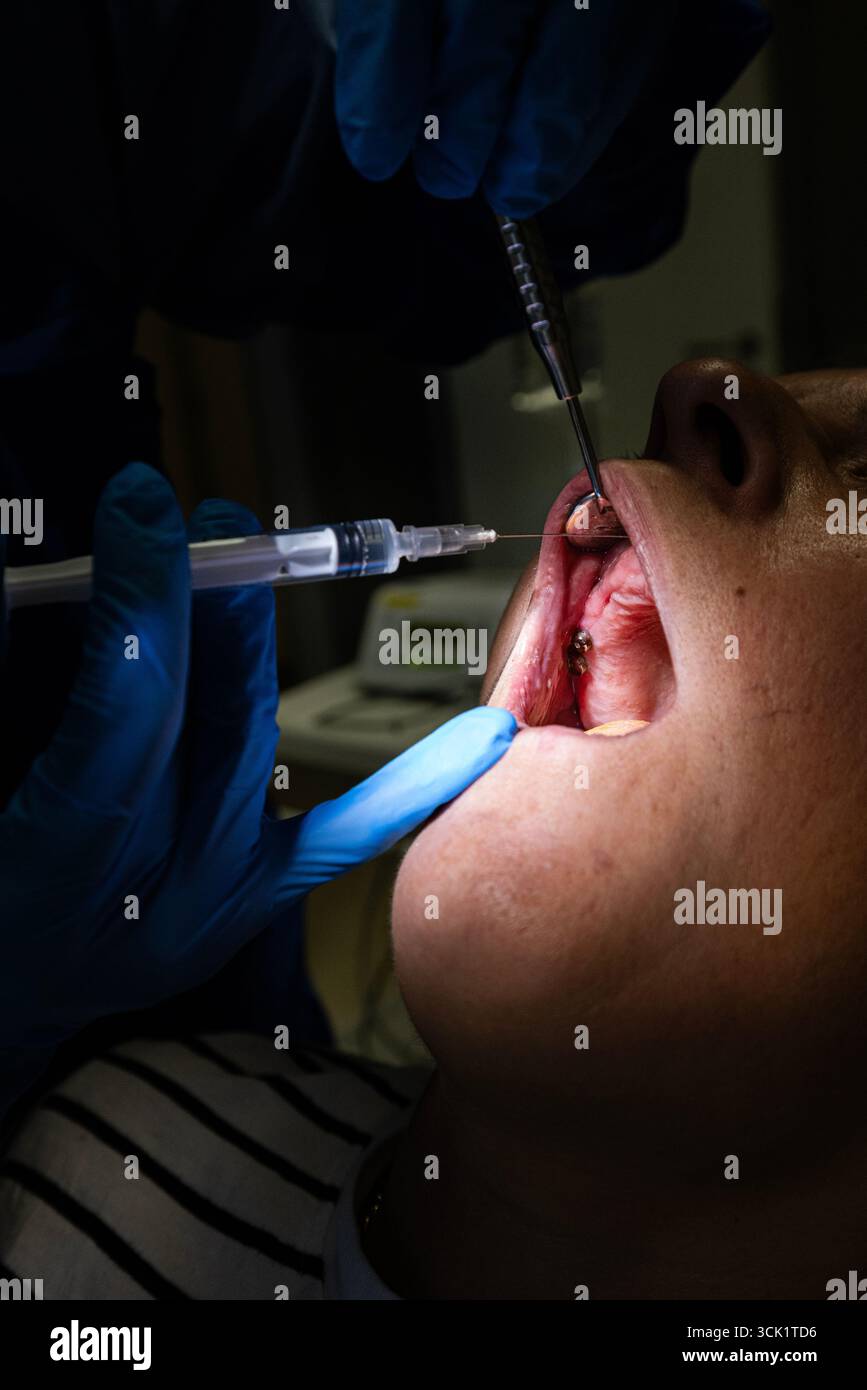 During implant treatment, a doctor performs an injection. The dentist ...