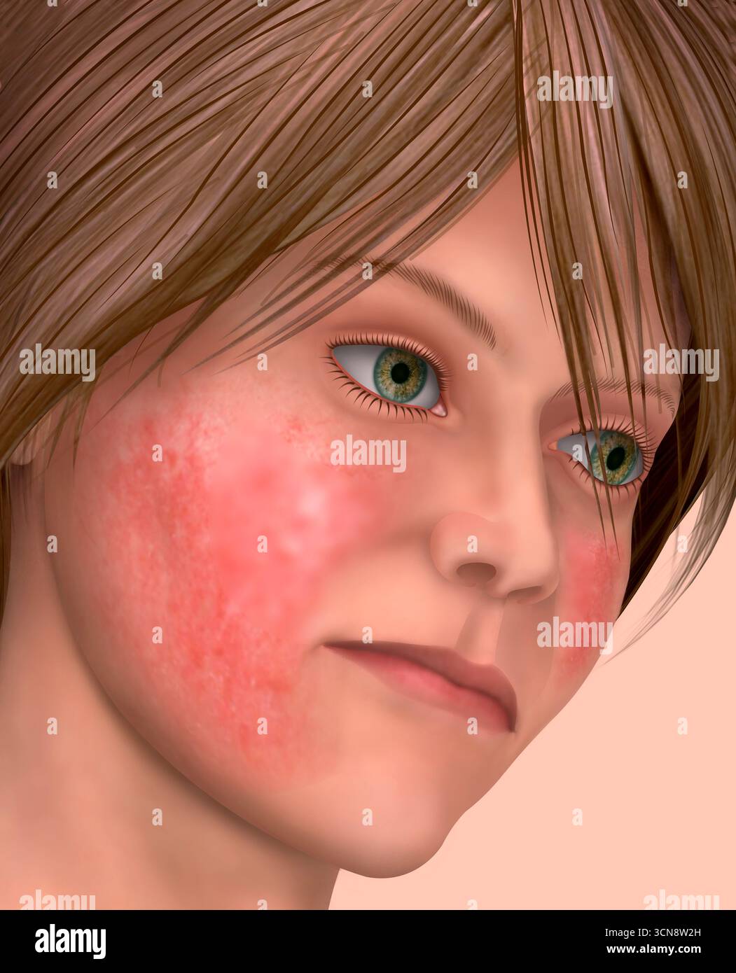 Red spots on the skin hi-res stock photography and images - Alamy