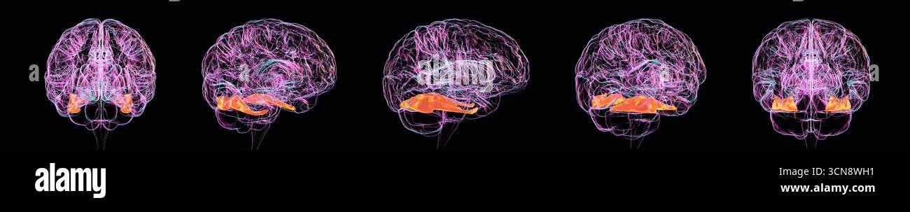 Illustration of the human brain with highlighted fusiform gyrus shown ...