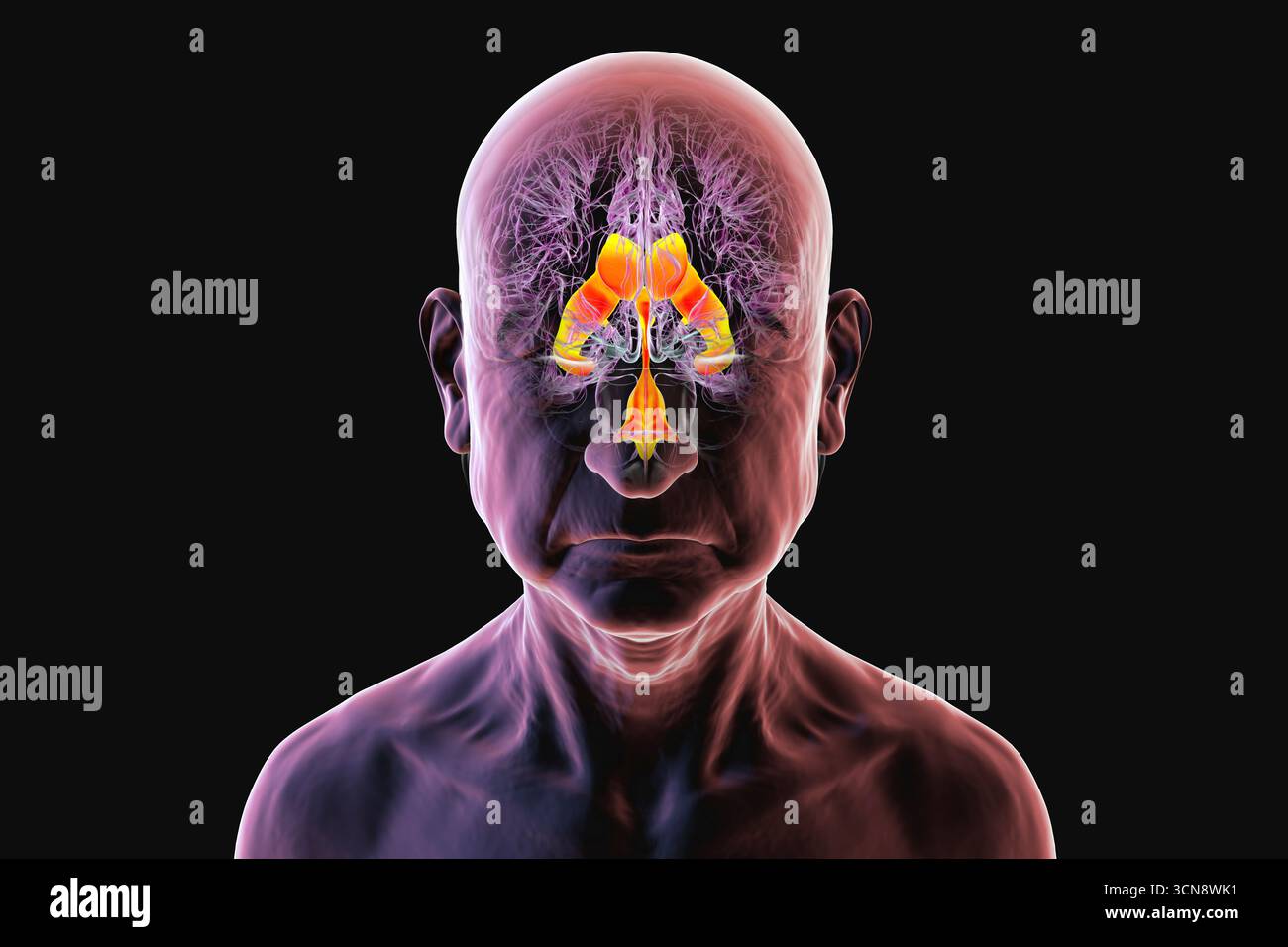 Illustration of the ventricular system of the brain in a senior person ...