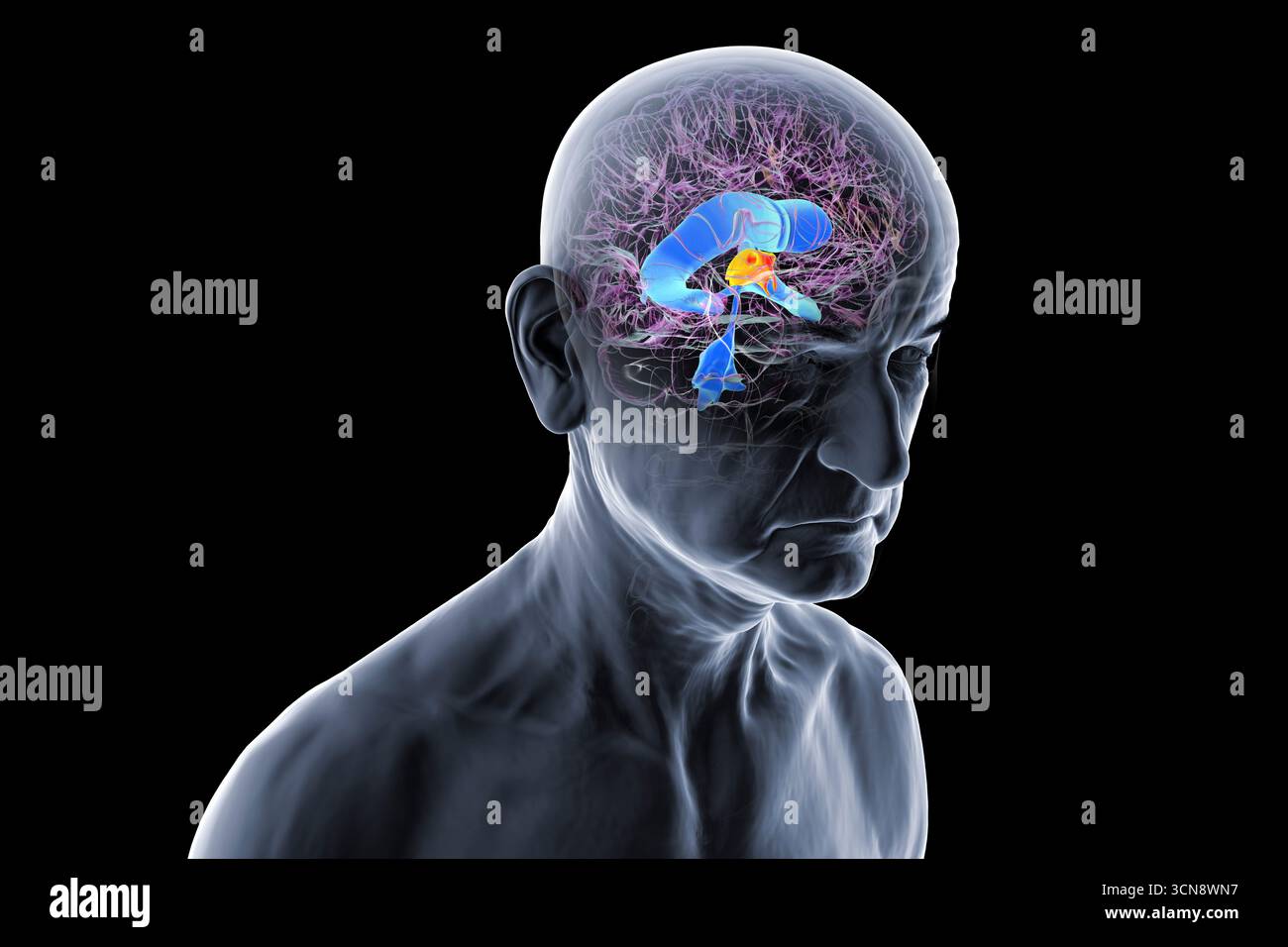 Illustration of the third brain ventricle (red) and ventricular system ...