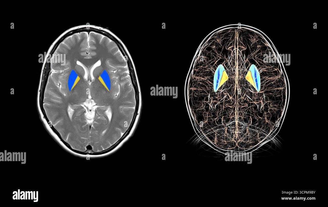 Human brain axial mri scan hi-res stock photography and images - Alamy