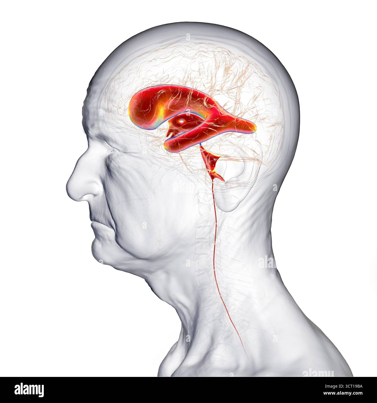 Illustration of a senior person's brain with normal pressure ...