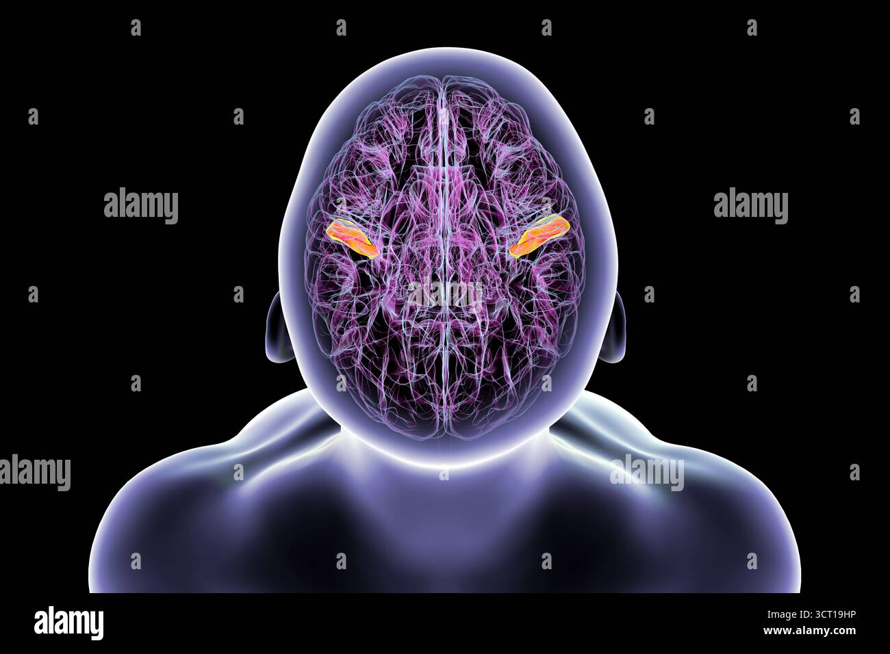 Illustration of the human brain with the transverse temporal gyri ...