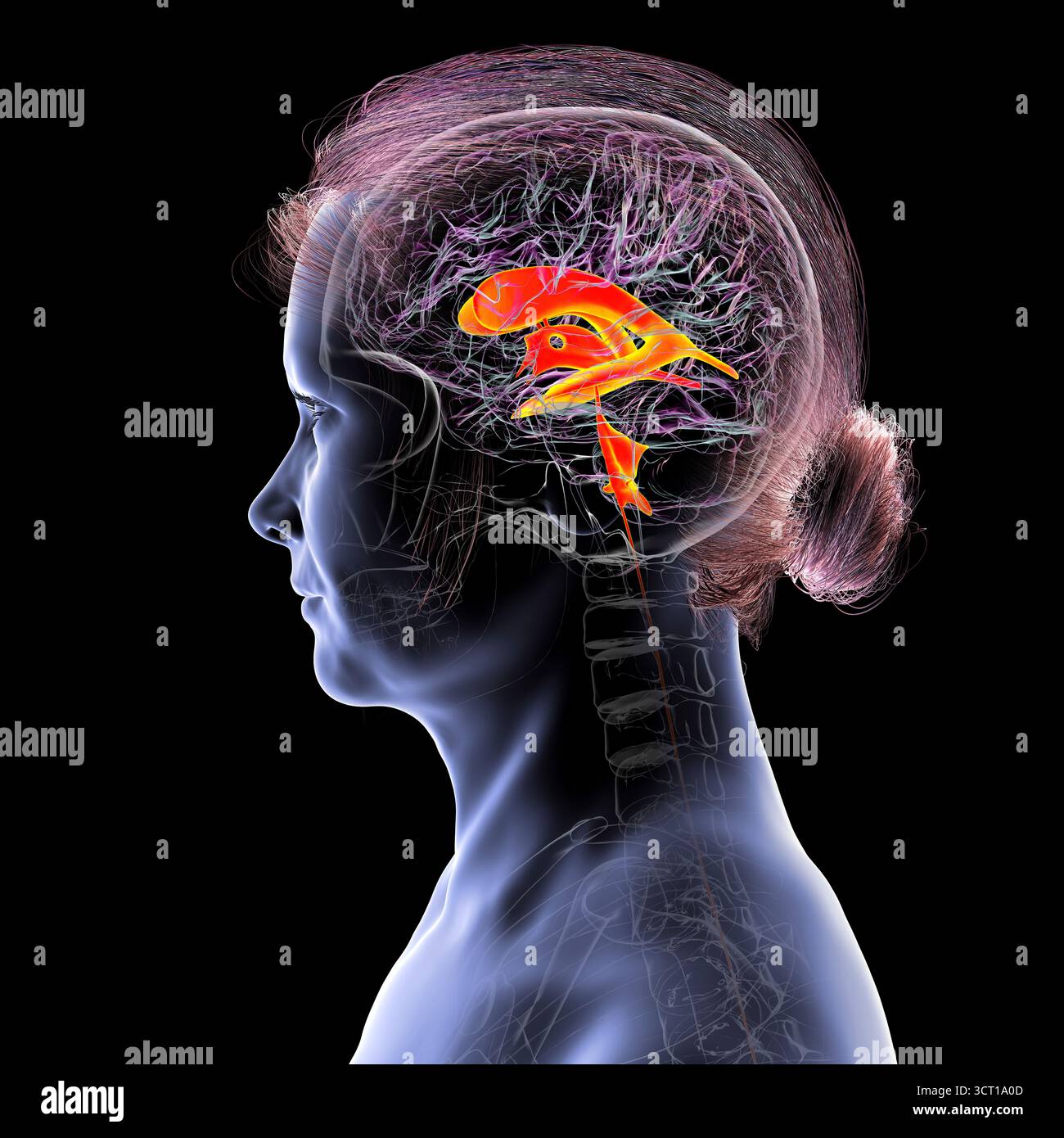 Illustration of the ventricular system of the brain. The ventricles are ...