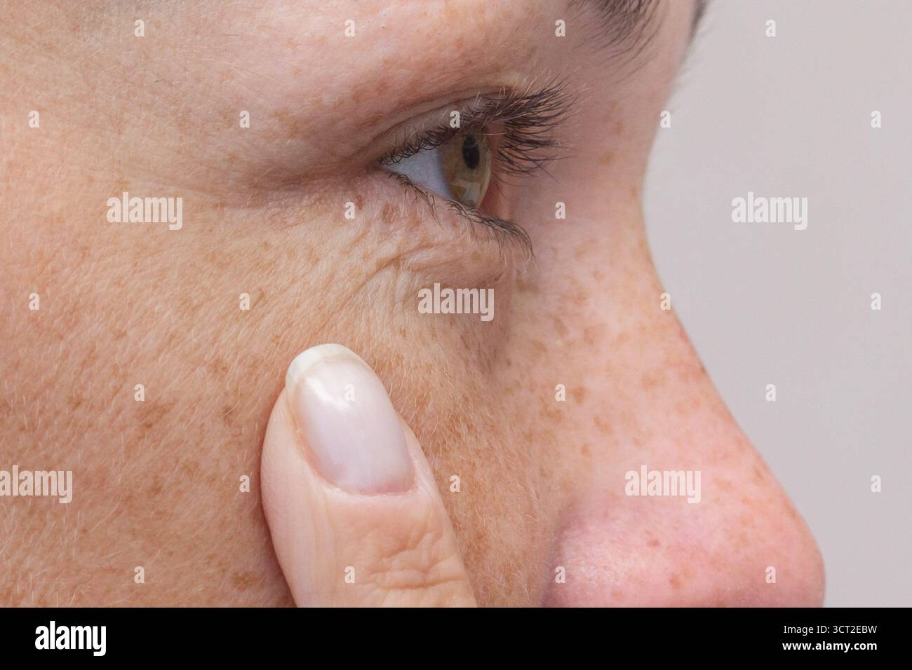 Close up of Womans Eye with Finger Highlighting Signs of Aging Stock Photo