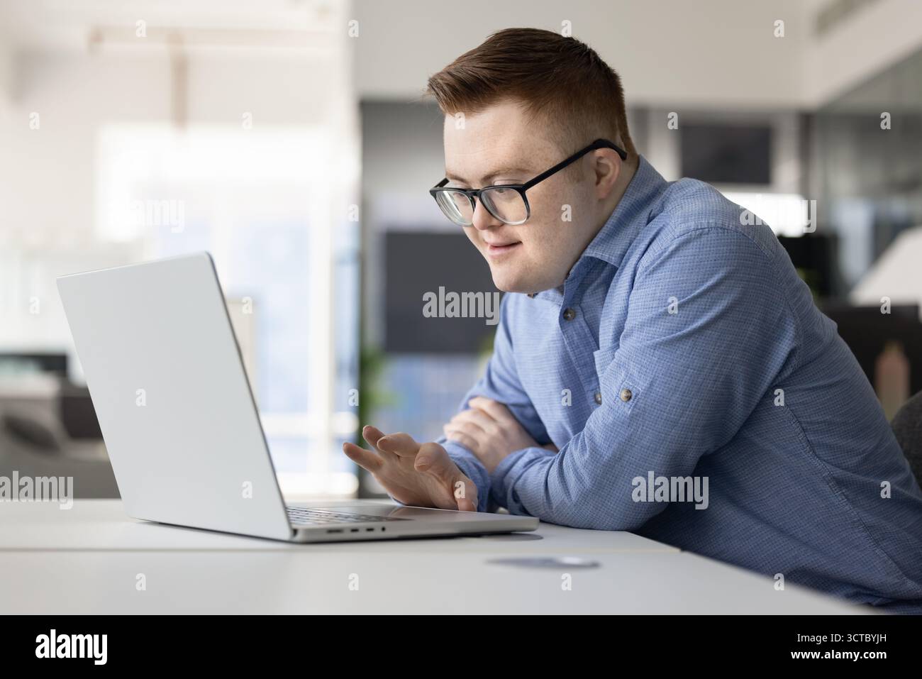 Positive inclusive company worker with Down syndrome typing on laptop ...