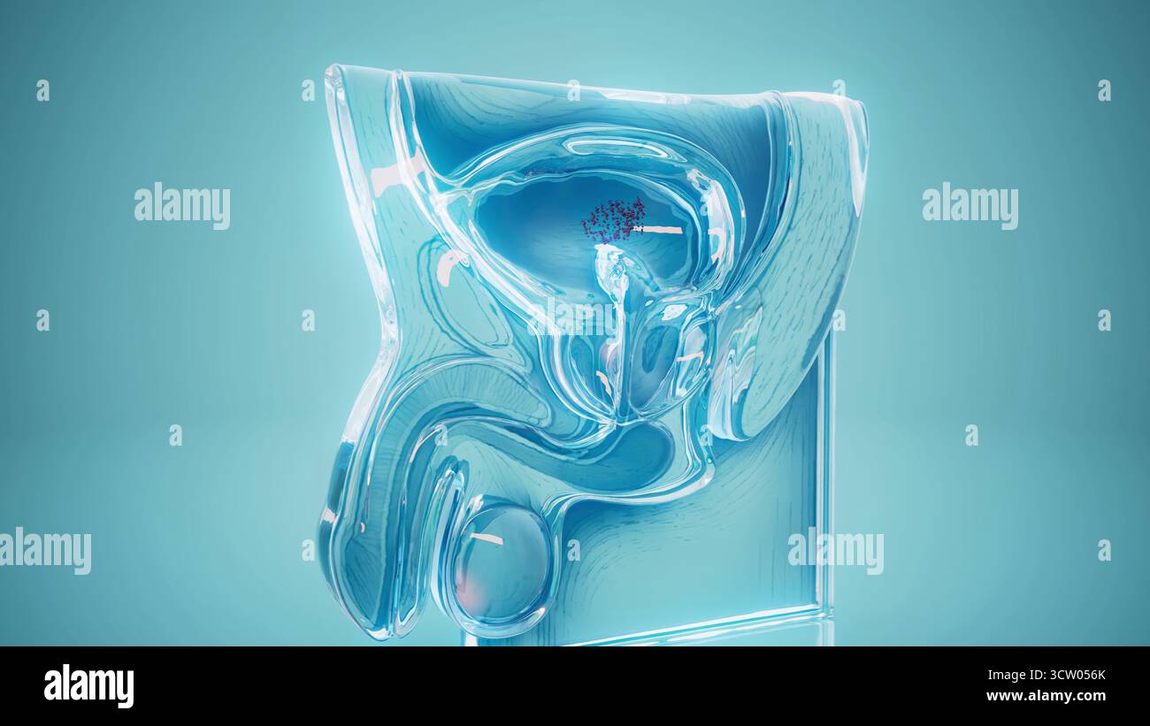 Bladder cancer mri hi-res stock photography and images - Alamy