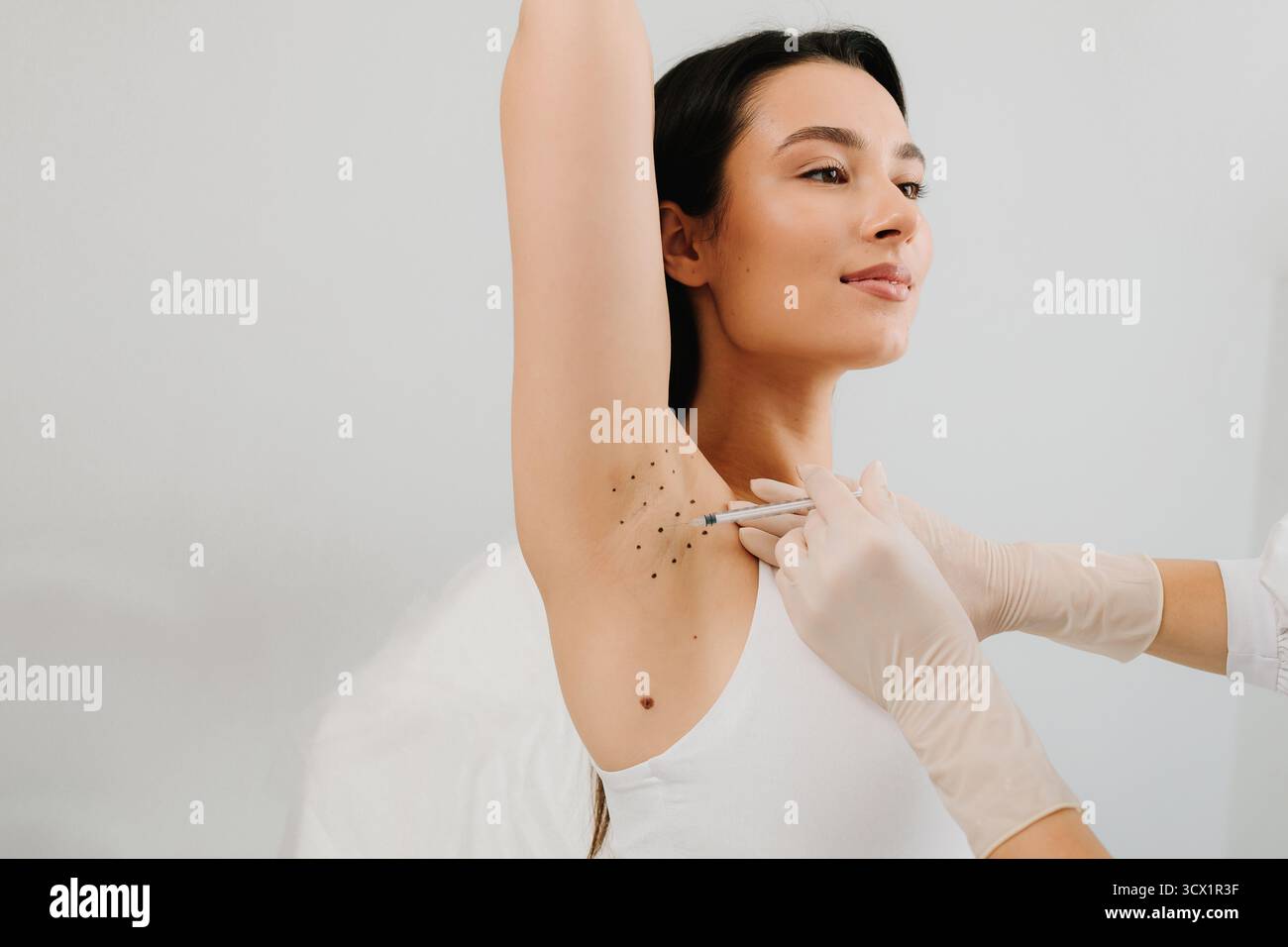 Hyperhydrosis Injection Hyperhidrosis injection for underarm. Intradermal injection procedure ...