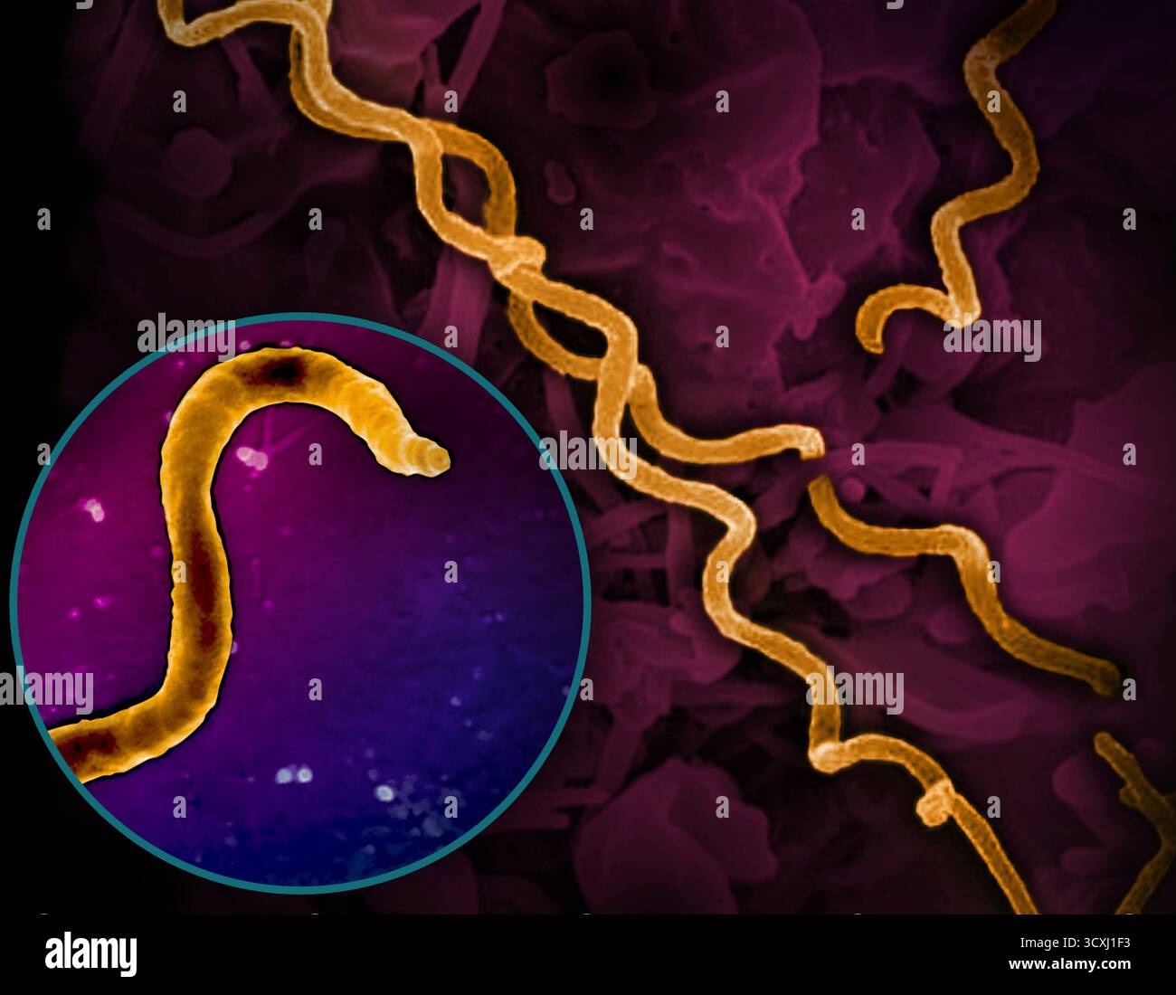 Syphilis Host Composite coloured scanning electron micrograph (SEM) of Treponema ...