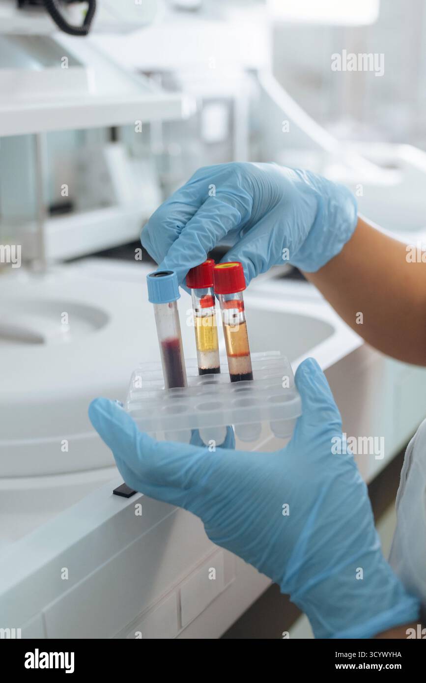 Female laboratory technologist putting test tubes with blood samples in a biochemistry centrifuge analyzer. Science and medicine concept. Stock Photo