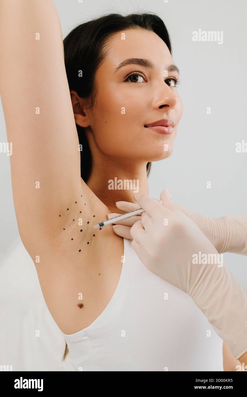 Hyperhydrosis Injection Cosmetologist performing botulinum toxin injections in a woman underarm ...