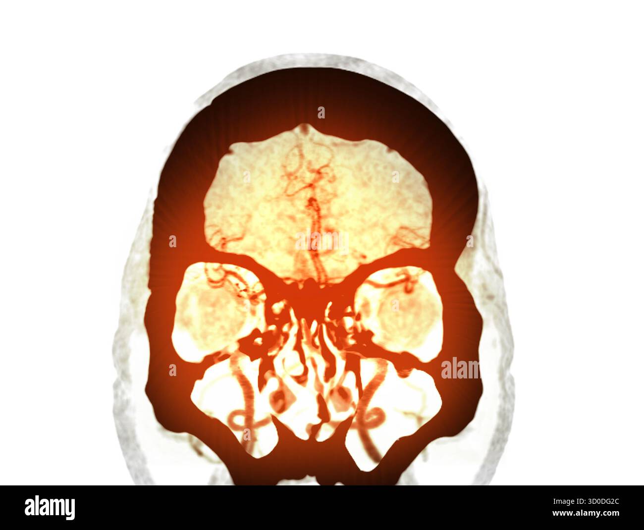 Cta cerebral artery hi-res stock photography and images - Alamy