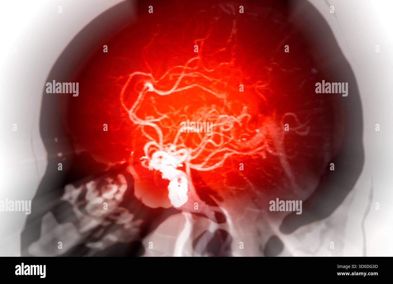 CTA Brain Vascular Imaging , highlights a detailed 3D CTA scan of the ...