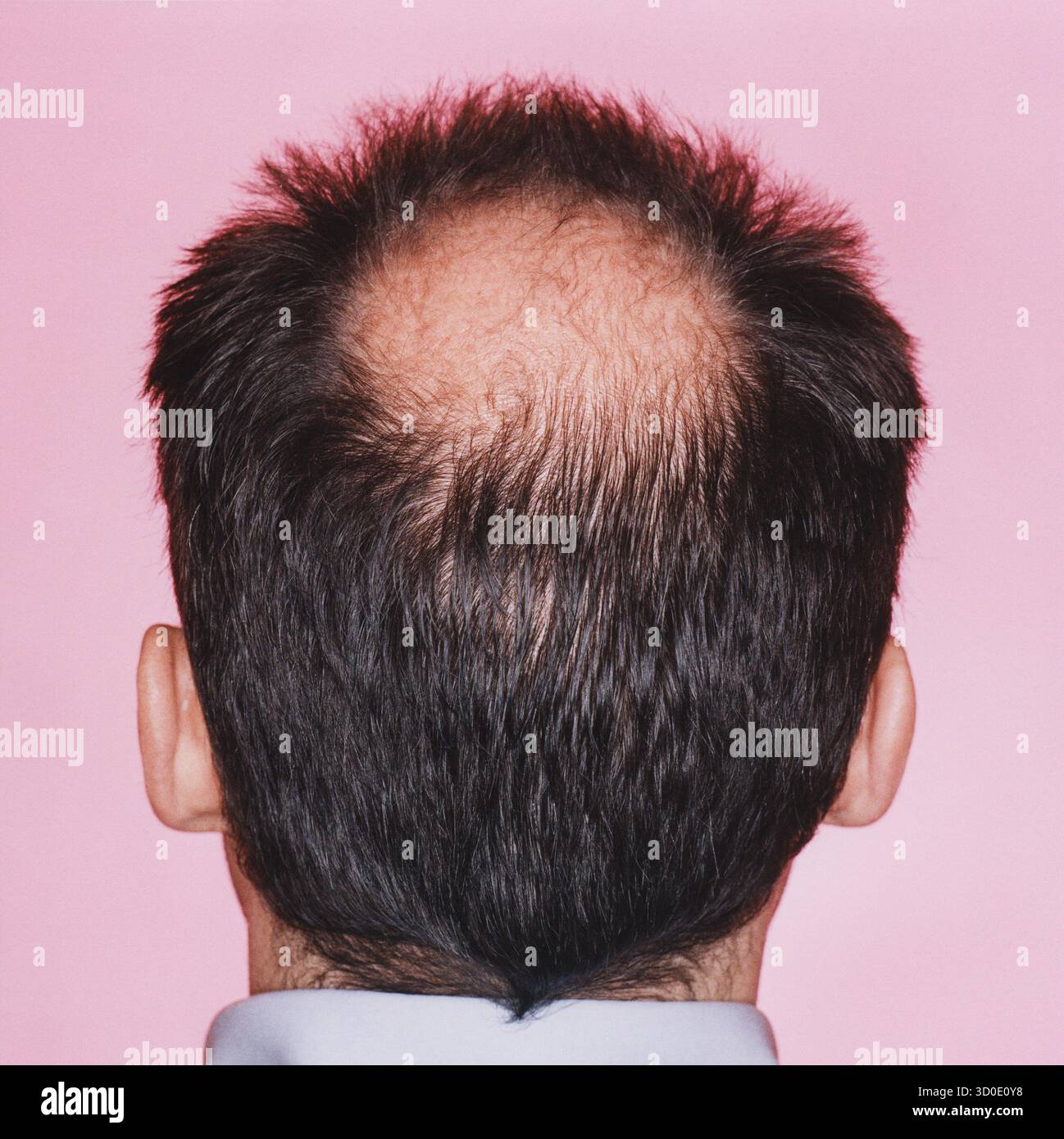 Balding head back view hi-res stock photography and images - Alamy