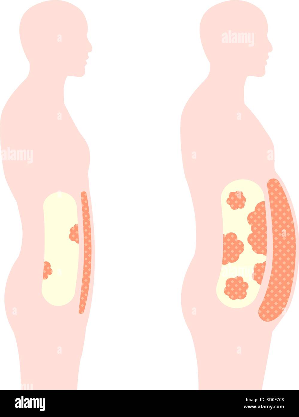 human-silhouette-illustration-of-visceral-fat-and-subcutaneous-fat
