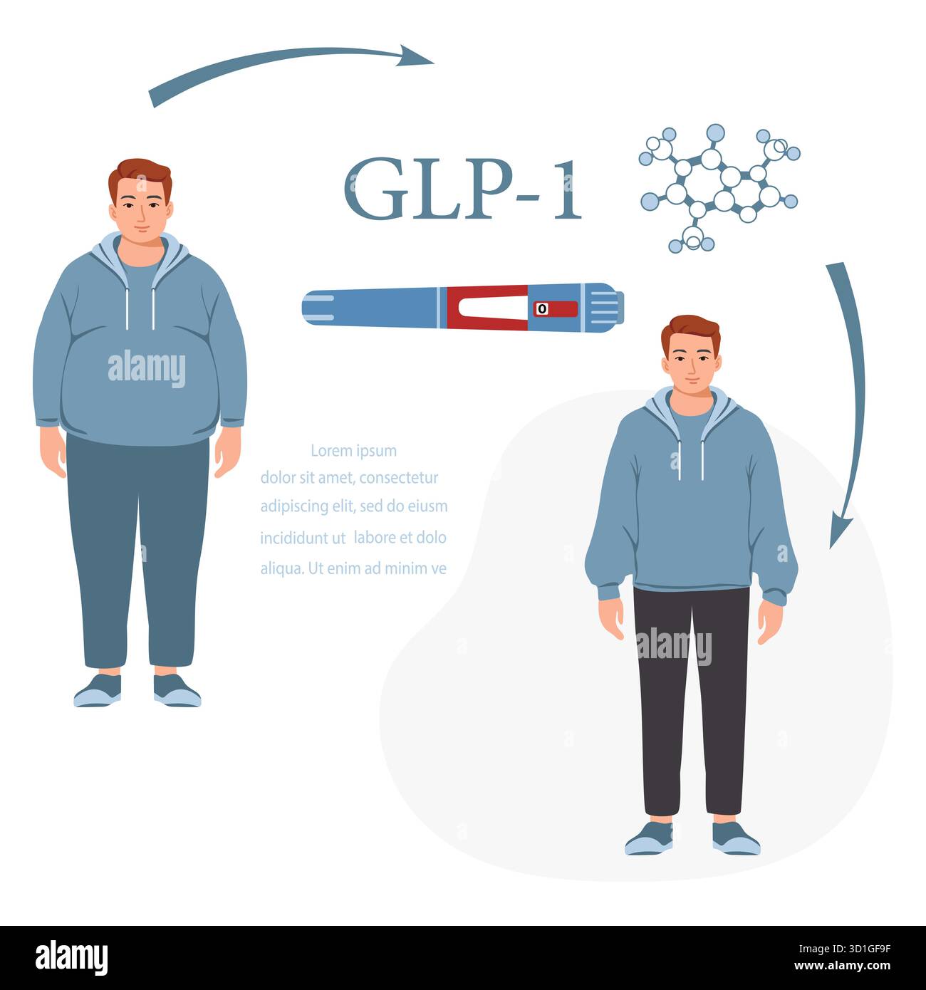glp 1 manufacturing GLP-1 shortage: Can biotechs keep up with rising demand?