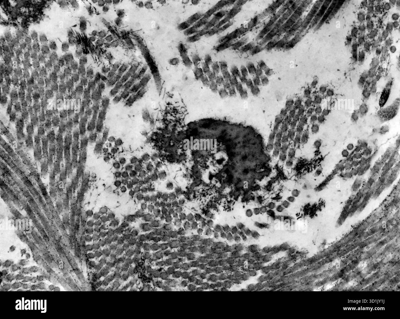 Transmission electron micrograph (TEM) showing collagen fibres in ...