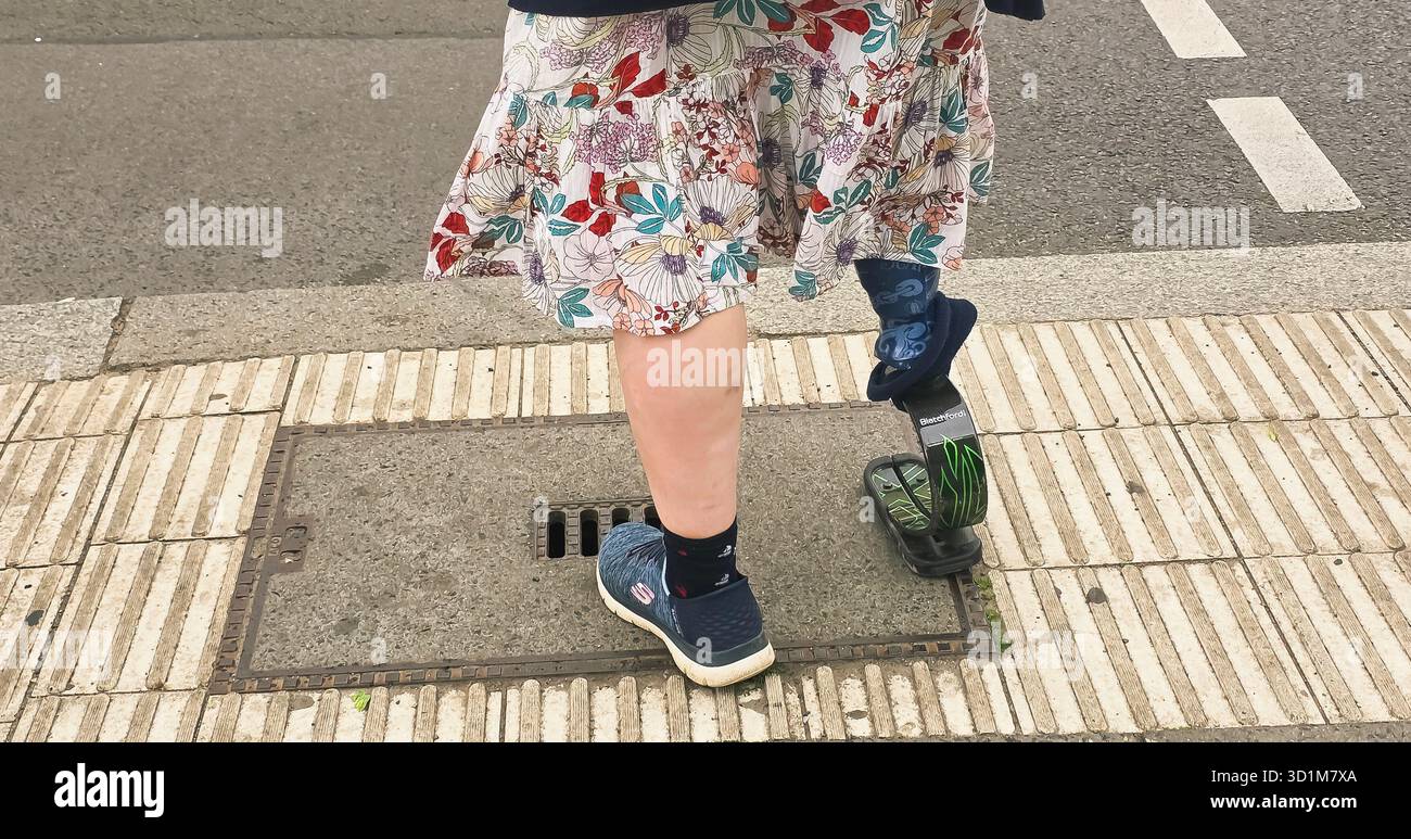 Berlin, Germany - June 02, 2025: unrecognizable Woman with prosthetic limb is walking on urban street wearing a floral dress. - Smartphone Captured Stock Image