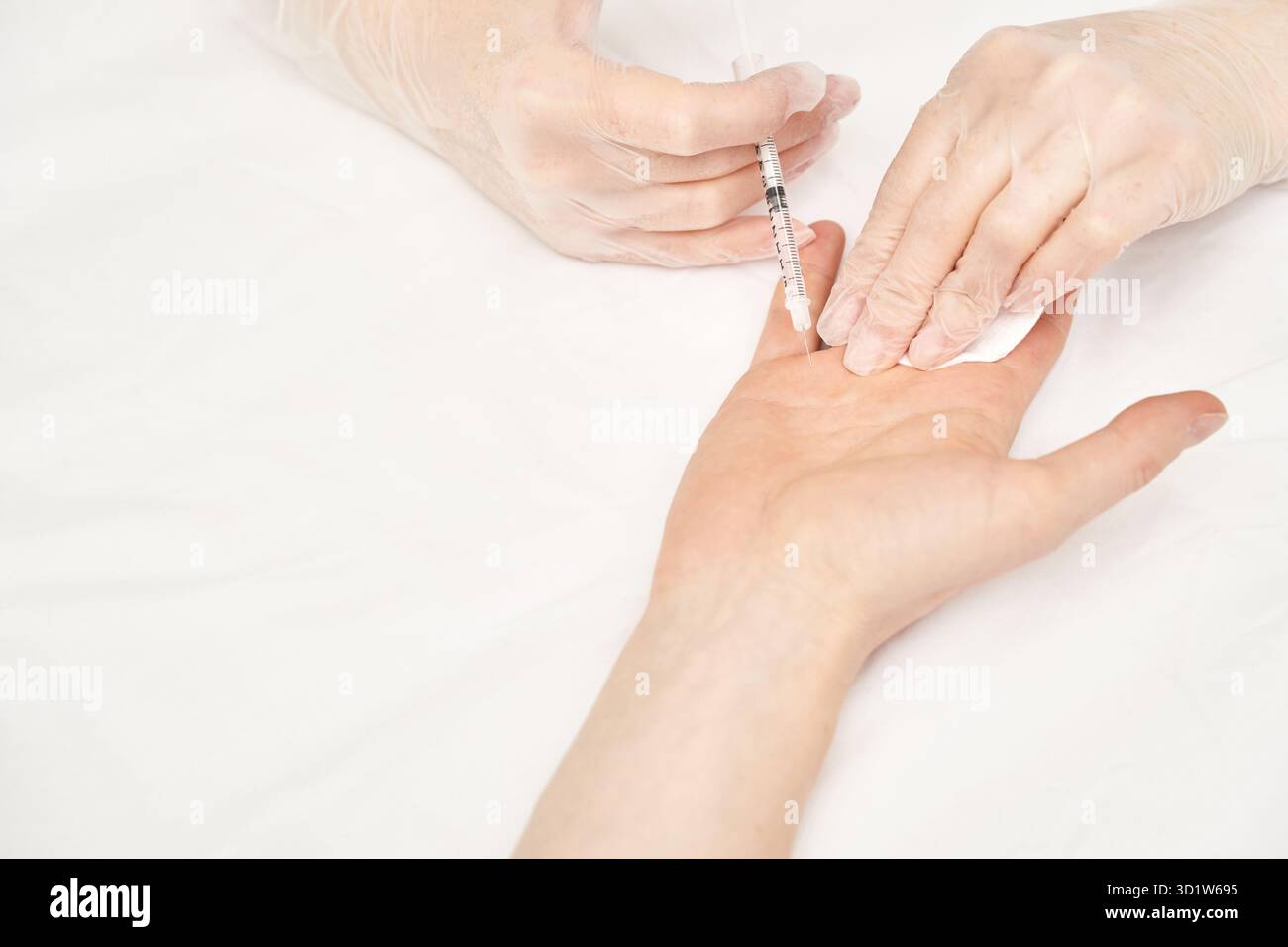 Palm injection at spa salon. Doctor hands in gloves. Closeup. Pretty ...