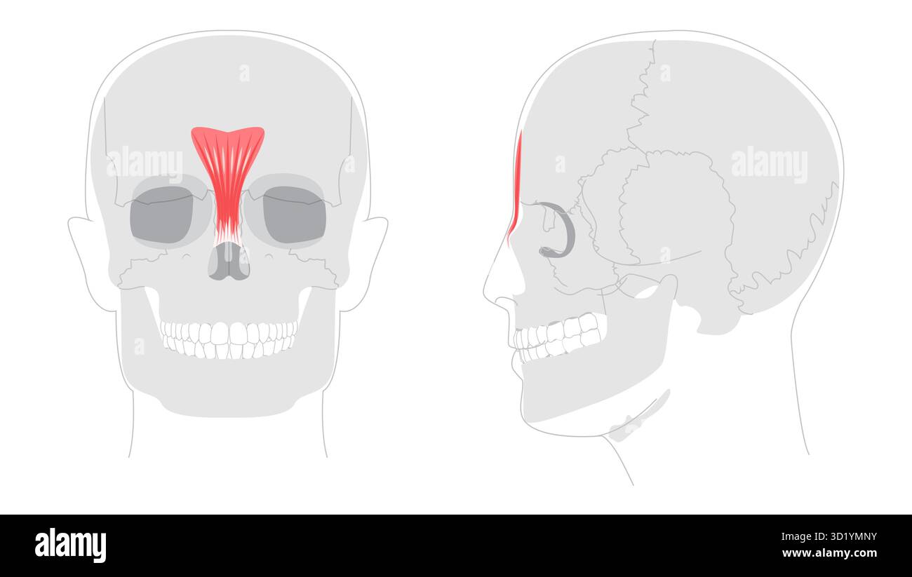 Procerus - Nasal muscle shown in anatomy diagram, responsible for ...