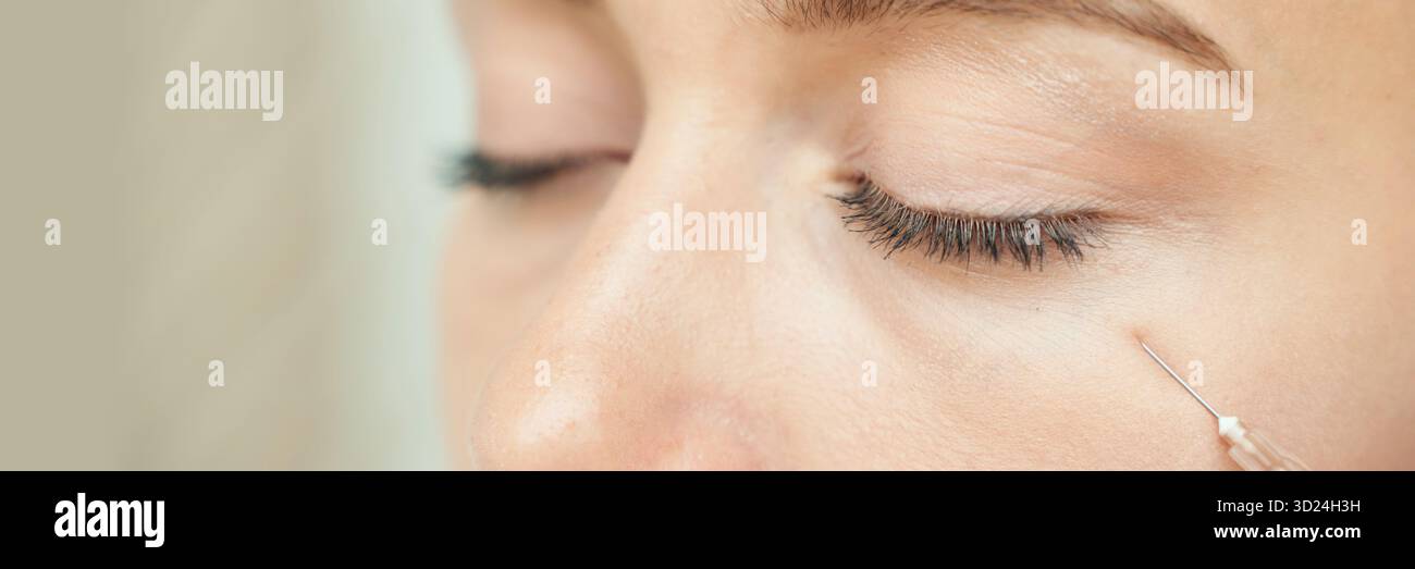 Close-up of young caucasian female receiving cosmetic injection under eye Stock Photo