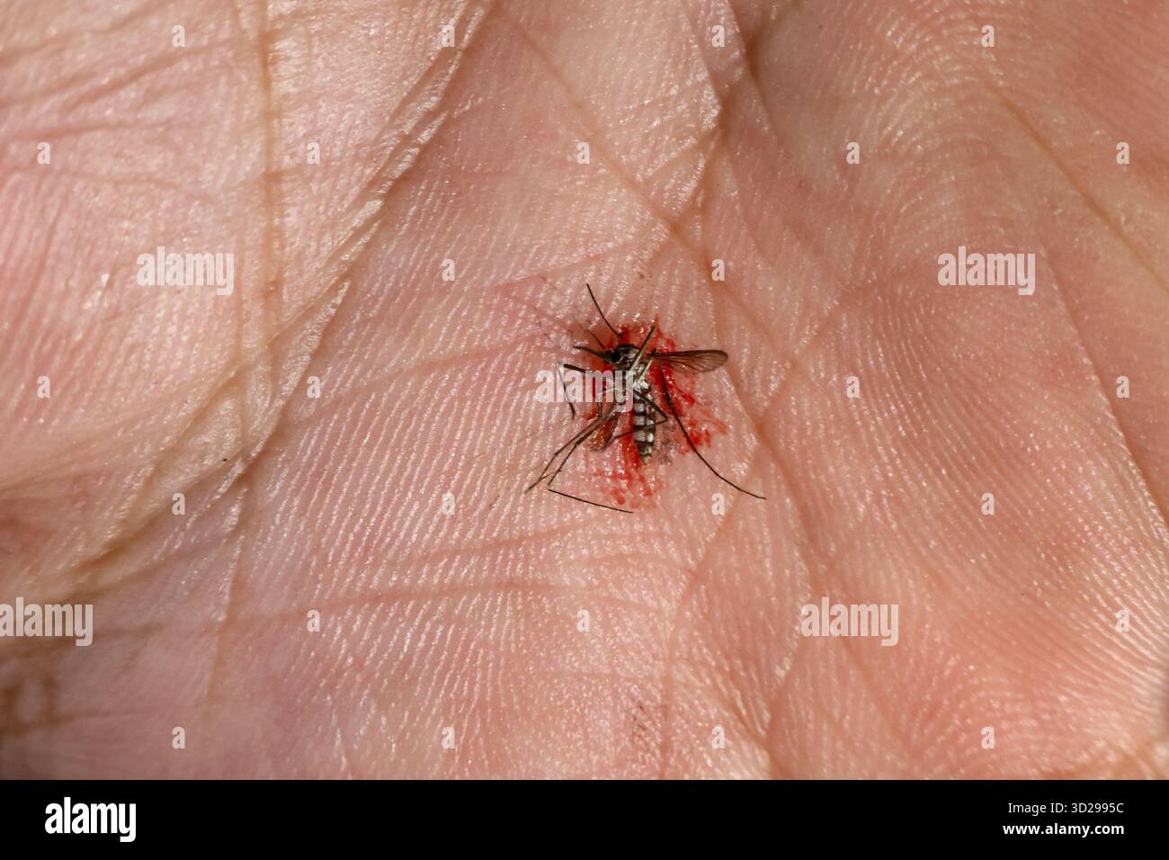 The mosquito on the palm that was slapped had blood coming out of its ...