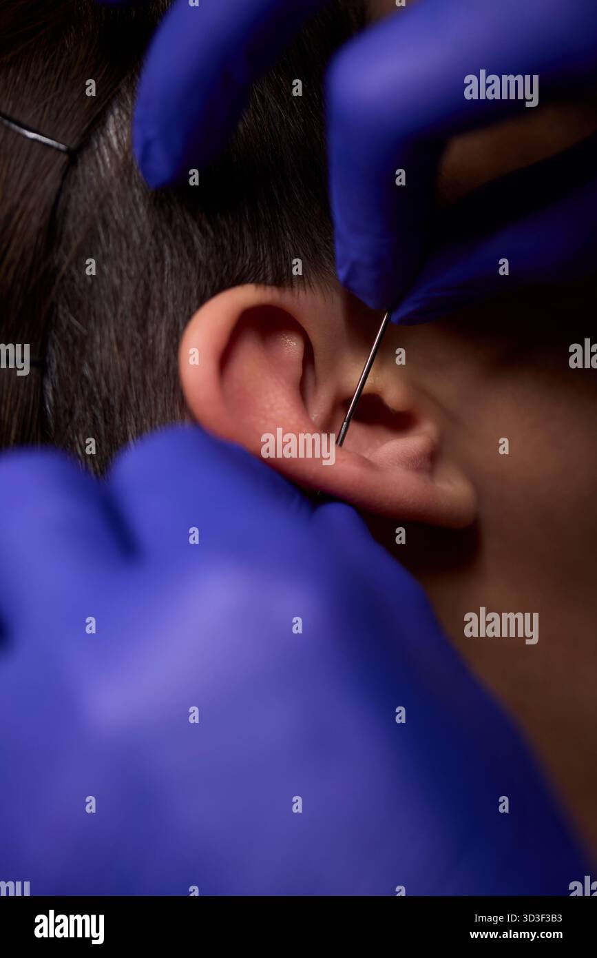 Piercing Processing Professional Piercing Process A detailed closeup view showcasing the ...