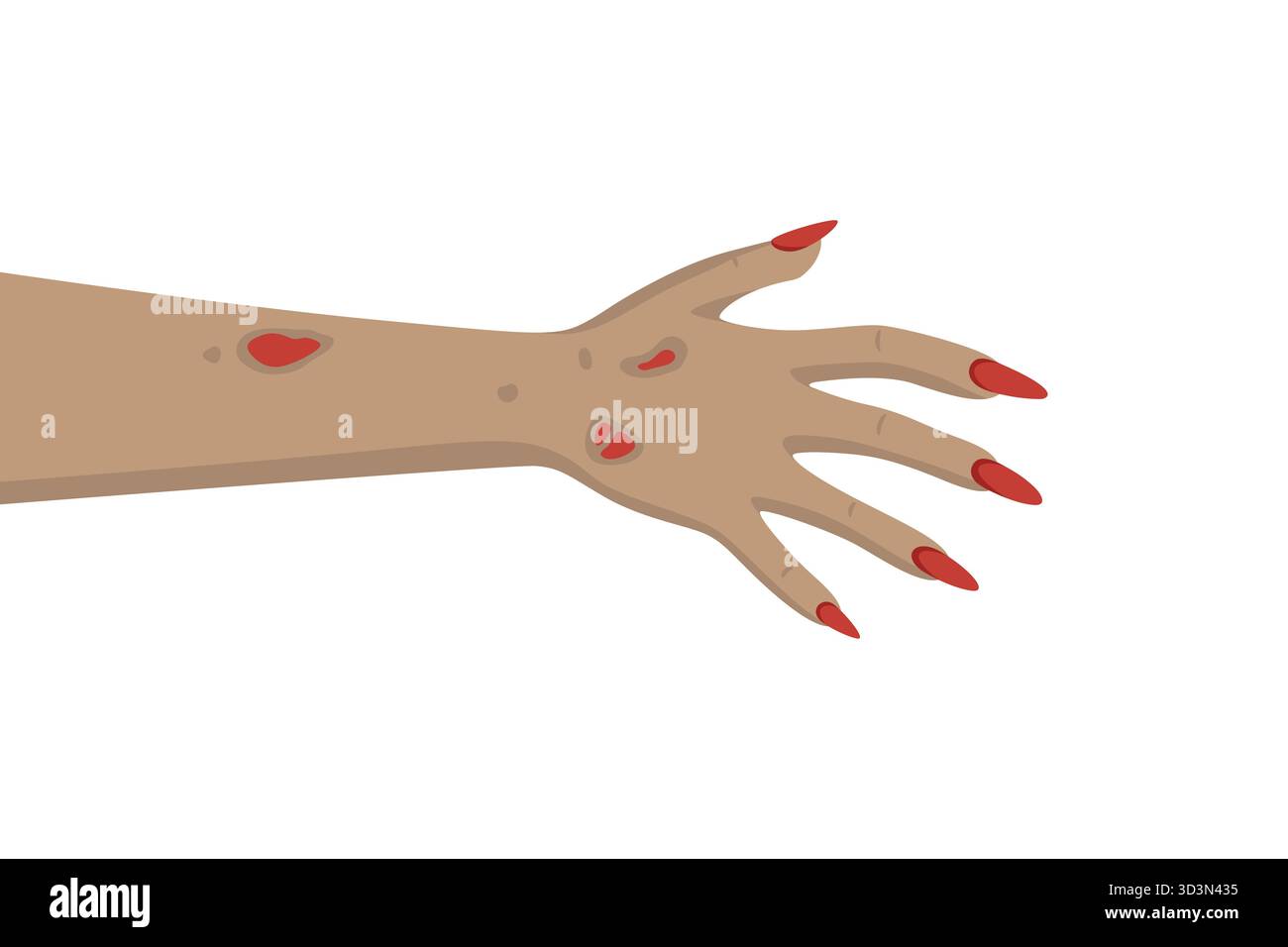 Zombie Hand with Scratches and Long Nails, Vector Illustration. Creepy ...
