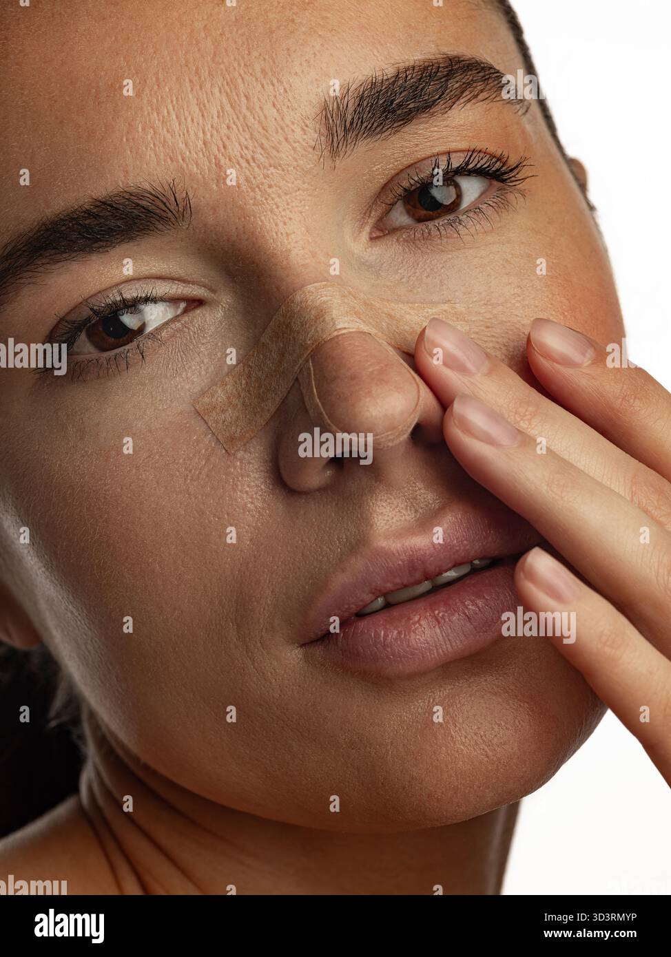 What Is a Nasal Hump?, image size:974x1390