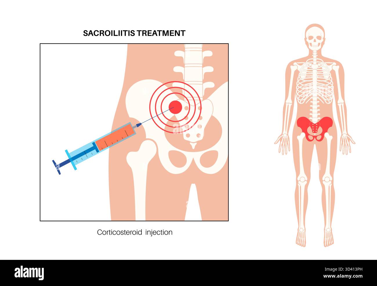 why b12 injections are painful How Long Do Vitamin Injections Last? Here's the Fact