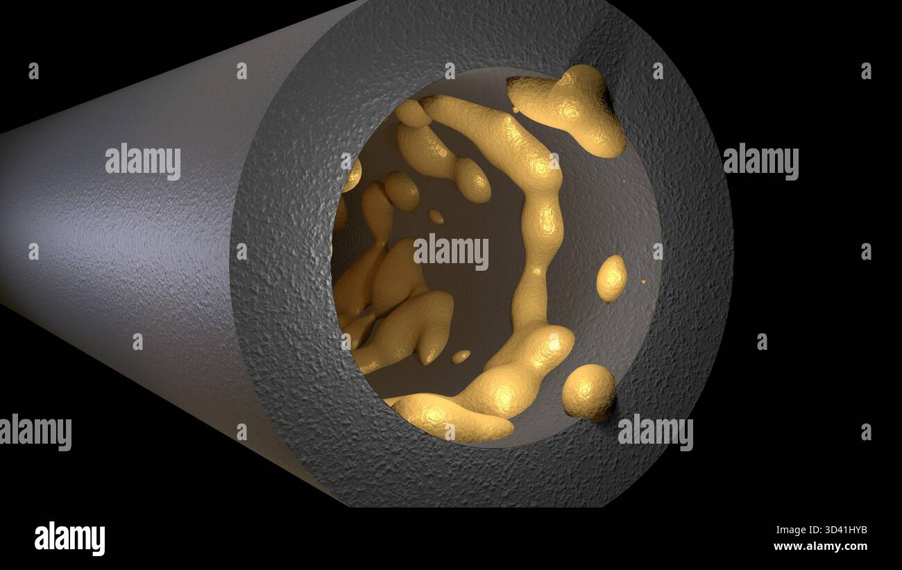 Biofilm formation hi-res stock photography and images - Alamy
