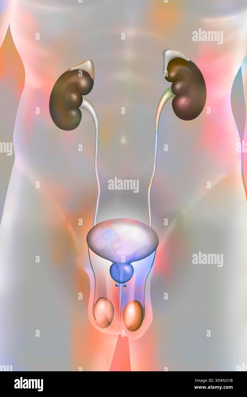 Illustration of bladder and prostate pathologies: cystitis (extremely ...