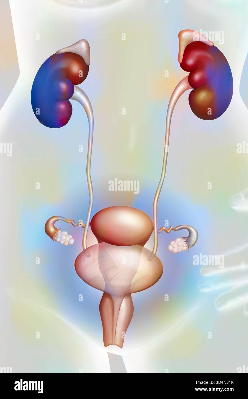Illustration of bladder pathologies: cystitis, cancer, lithiasis Stock ...