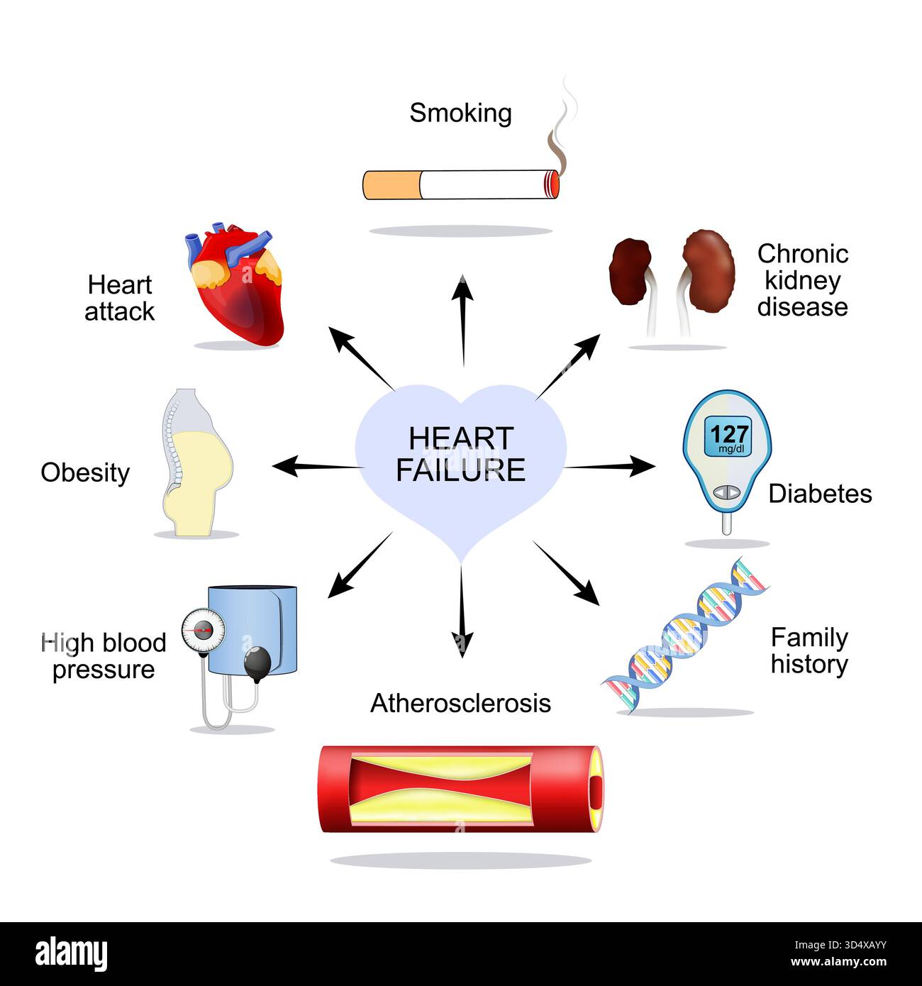 Cardiovascular risk factors Stock Vector Images - Alamy