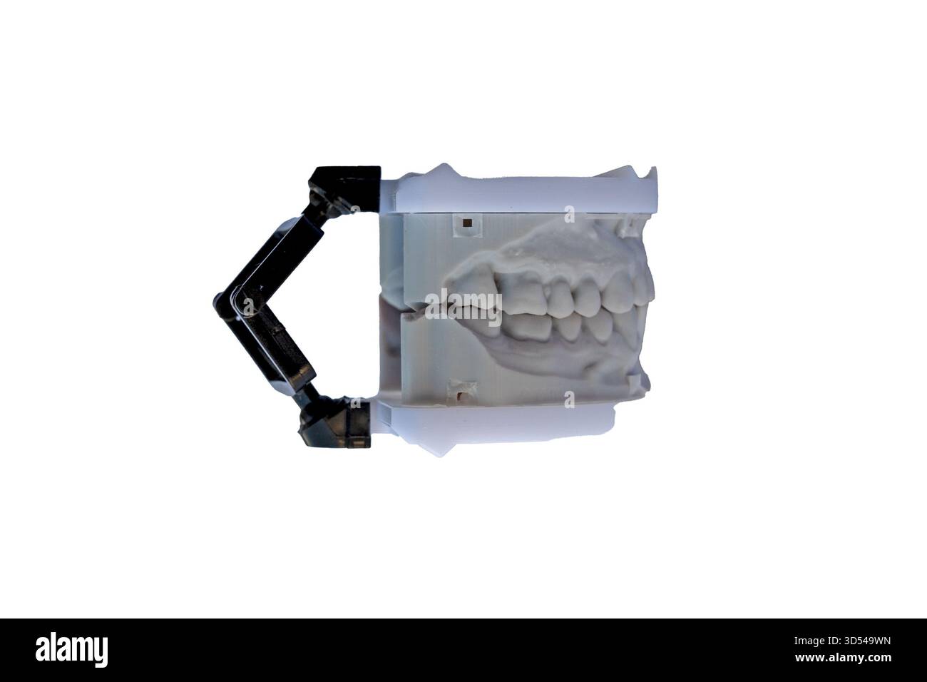 Dental model with upper and lower teeth mounted in plastic articulator ...
